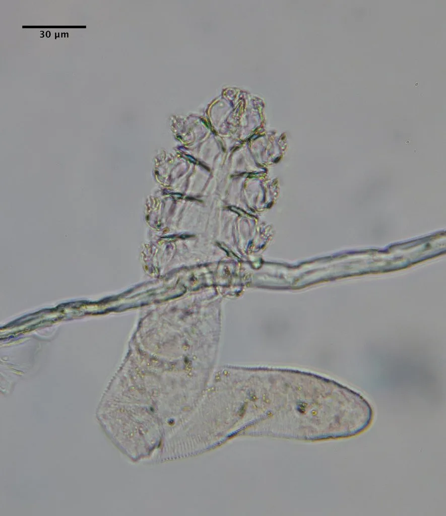 Demodex folliculorum